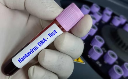 ¿Qué es el hantavirus?; La enfermedad se transmite por contacto con roedores