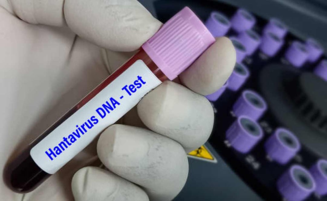 Hantavirus. Foto: iStock