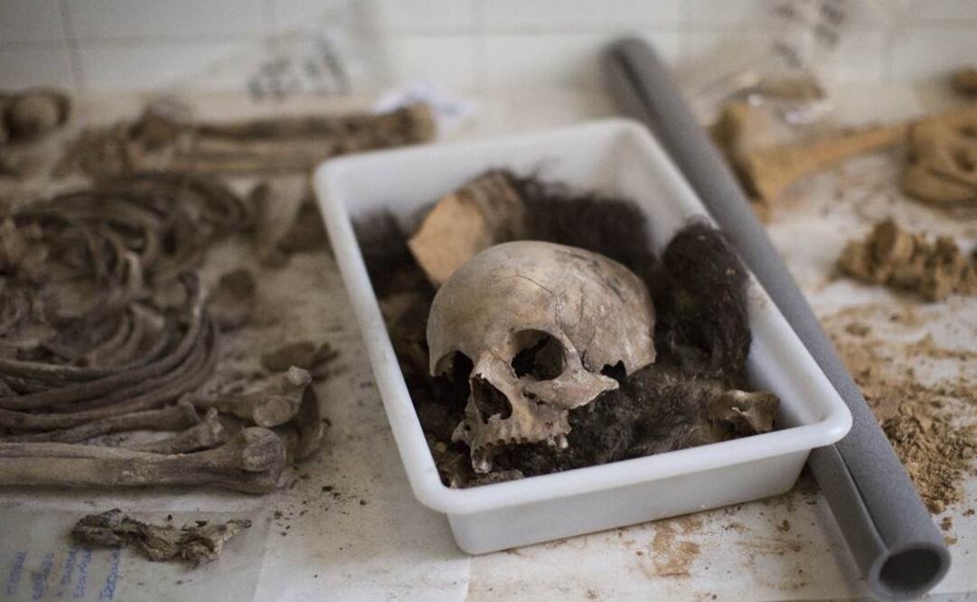 (AP Photo/Emilio Morenatti)