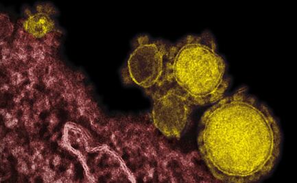 Nueva prueba detectaría anticuerpos de Covid-19 en unos segundos