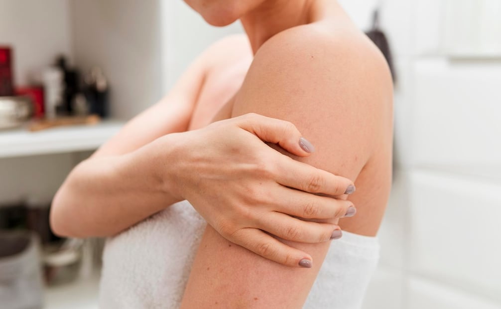 La acumulación de células muertas impiden la regeneración de la dermis, lo que causa oscurecimiento en codos, rodillas y nudillos. Foto. Freepik