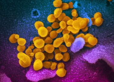 Descubren que proteína del coronavirus presenta 13 mutaciones a la vez en Tanzania
