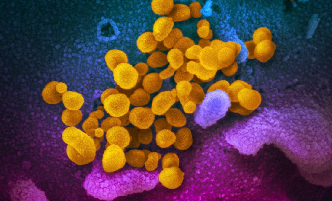 Foto: NIAID-RML via AP, archivo