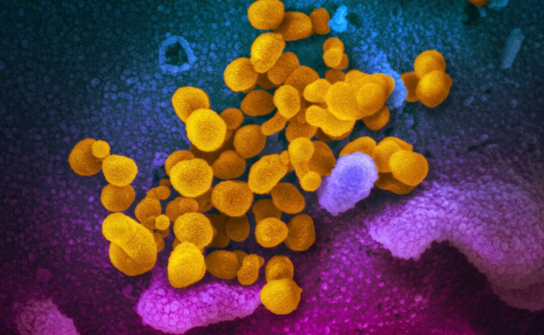 Foto: NIAID-RML via AP, archivo