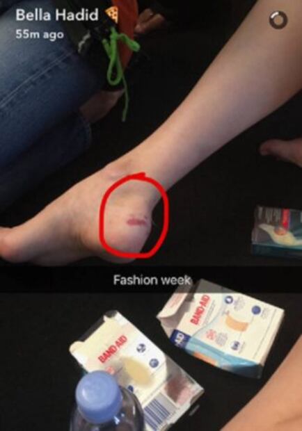 ¡Bella Hadid sufre caída en pleno desfile!