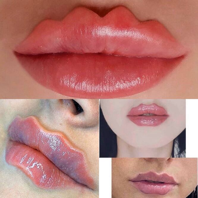 Esta nueva tendencia en los labios podría tener estragos en tu salud / Foto: Reddit