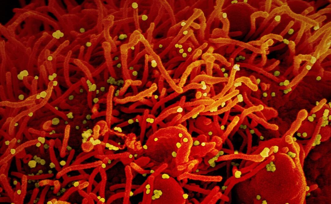 EFE/EPA/NIAID/NATIONAL INSTITUTES OF HEALTH