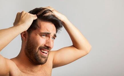 Top 3 de las mejores clínicas para injerto de cabello en Ciudad de México