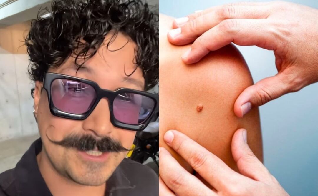 El comediante mencionó que le detectaron cáncer de piel. Foto: Redes Sociales