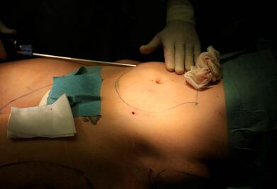 Crónica. “Ya venía mal; tenía varias manchas negras”