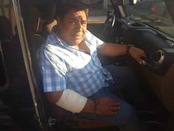 Quitan custodia policiaca a periodista de Oaxaca que fue agredido a balazos