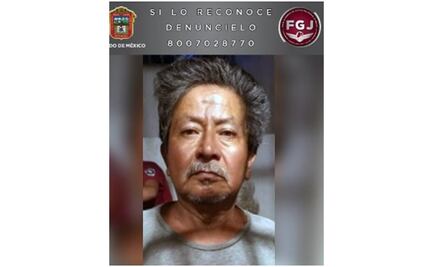 Le dan 30 años de cárcel por prenderle fuego a su esposa en Chalco