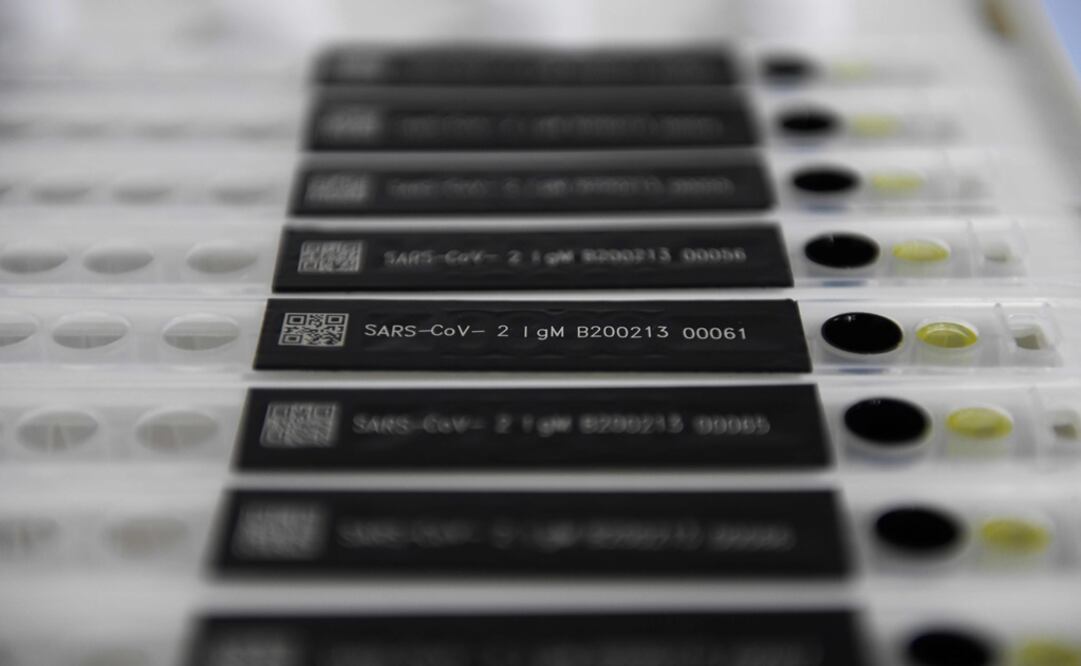 A COVID-19 coronavirus antibody test kits at Sophonix, a company which produces test kits for medical use, in Beijing - Photo: Greg Baker/AFP