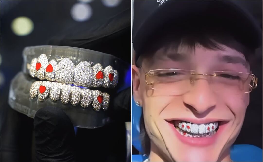 Peso Pluma estrenó dentadura de diamantes.
Fotos: Instagram