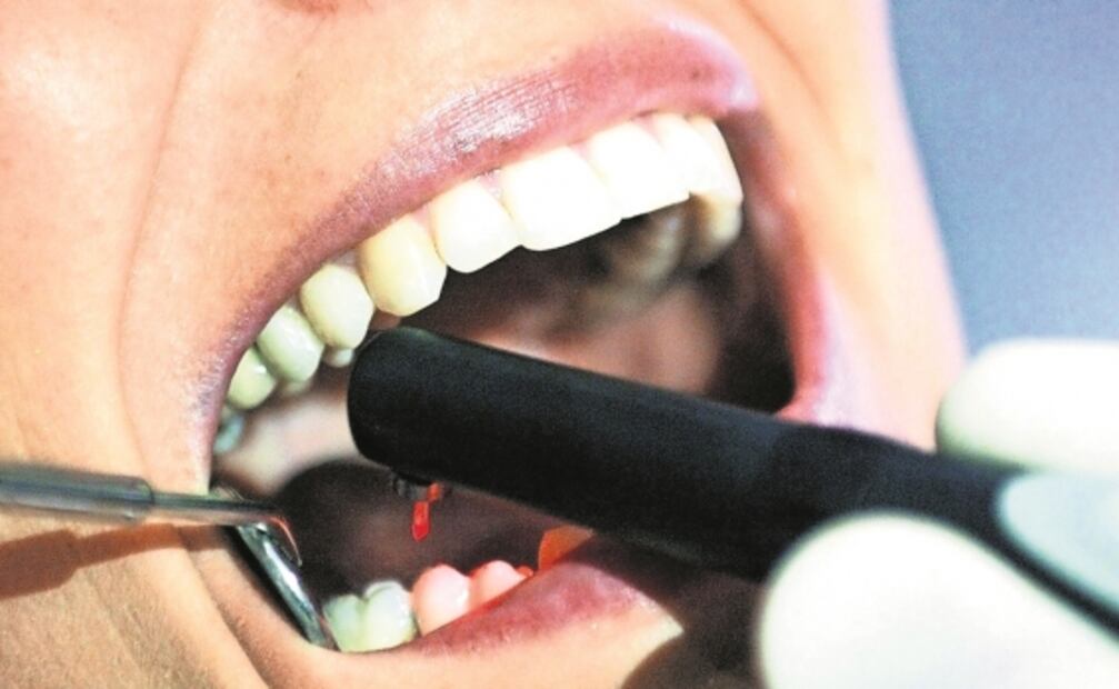  Descubren cómo es que los dientes perciben el frío