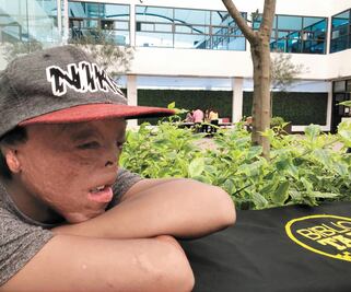 Juan lucha por recuperar lo que el fuego le quitó de bebé