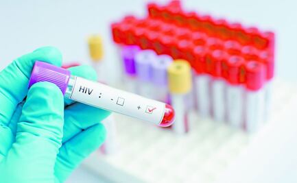 Confirman segundo paciente con VIH que se cura con trasplante de células madre