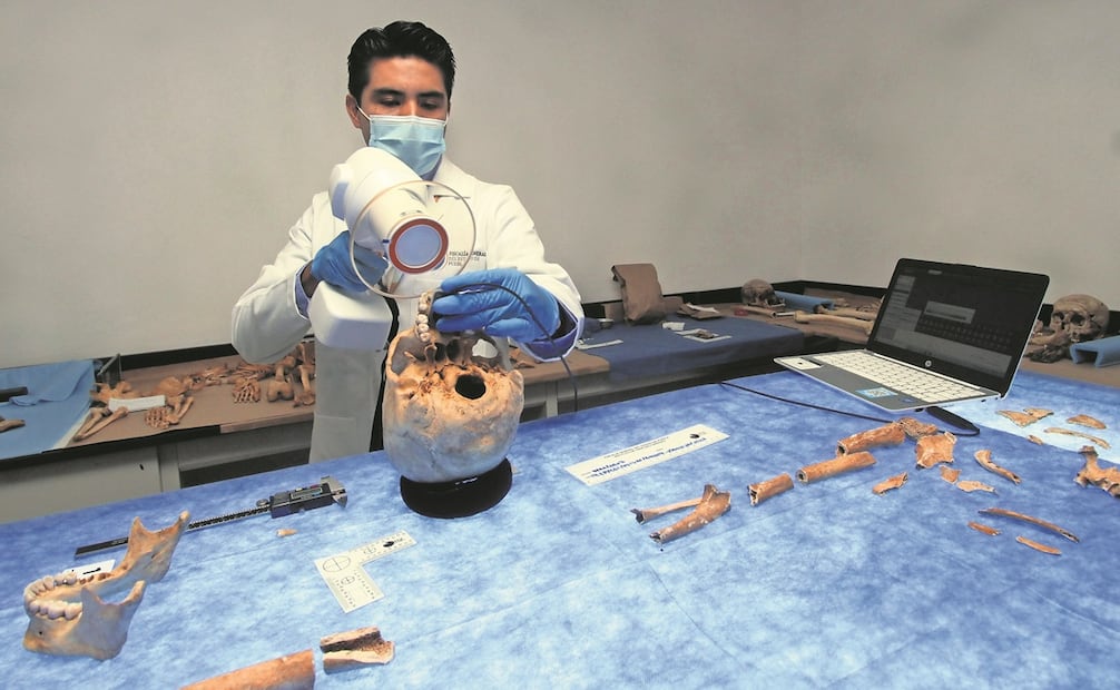 Las evaluaciones a través de las piezas dentales pueden detectar elementos significativos, Foto: Omar Contreras / EL UNIVERSAL