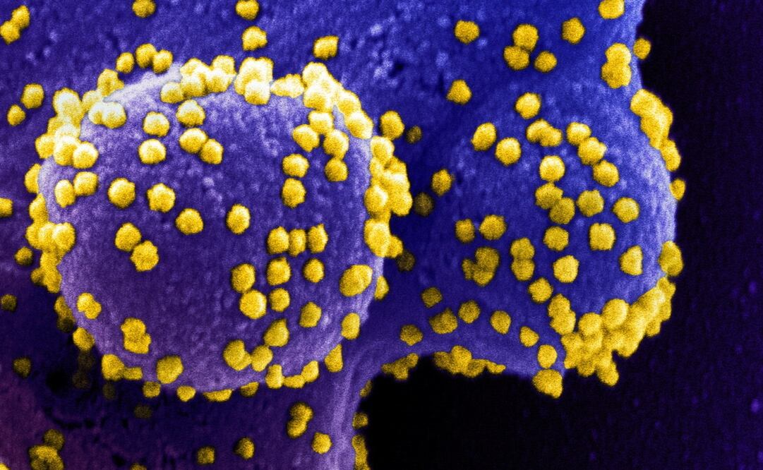 Foto: EFE/EPA/NIAID/NATIONAL INSTITUTES OF HEALTH HANDOUT 