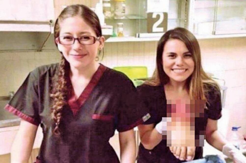 Tras viralizarse un video con una pierna amputada en marzo pasado, la doctora Ana Paulina Sánchez Palafox (izq) fue despedida. (ARCHIVO EL UNIVERSAL)