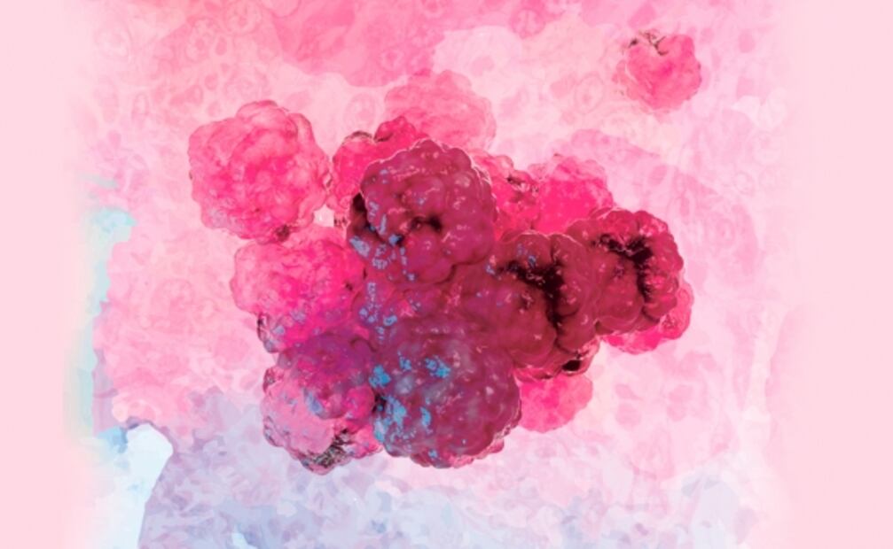 Humo de leña, factor de riesgo relacionado con más del 35% de los casos de cáncer de pulmón en México