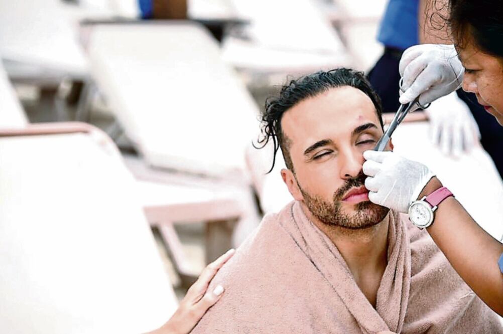 Apio Quijano requirió curación en el rostro. FOTOS: CORTESÍA