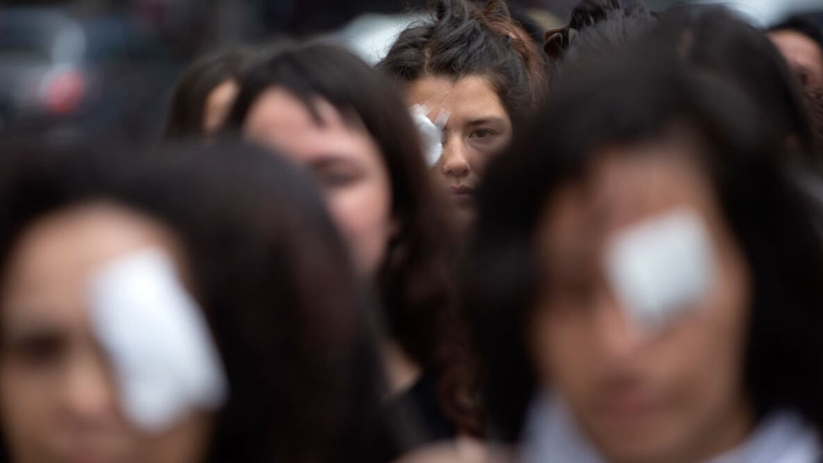 Una protesta de mujeres en Chile contra el uso de las balas de goma durante las manifestaciones. Foto: Getty Images