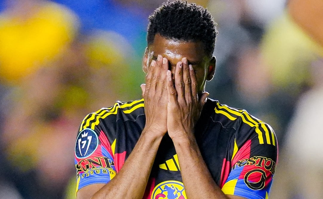 Raúl Zúñiga sufrió una fractura de clavícula. FOTO: IMAGO7