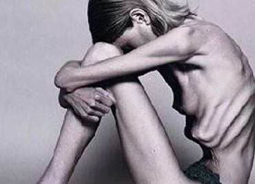 Casos de bulimia y anorexia aumentan en niños, alerta especialista