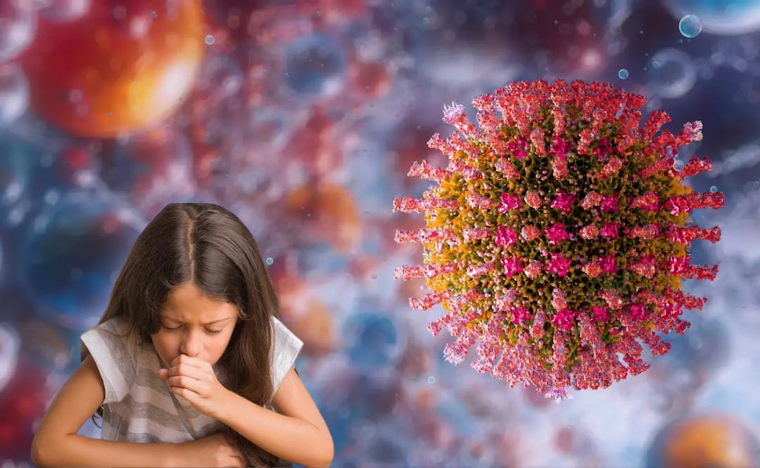 El sarampión se mantiene como una enfermedad viral aguda y extremadamente contagiosa .
Foto: El Universal