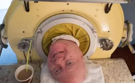 La increíble historia de Paul Alexander: el hombre que lleva 65 años en un pulmón de acero