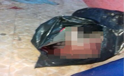 Encuentran a su hija embolsada en GAM