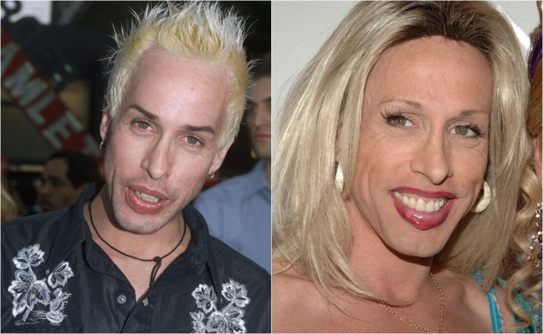 Arquette era famosa por la defensa de los derechos de la comunidad trans FOTO: ARCHIVO