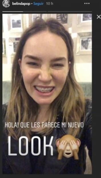 Belinda luce su sonrisa con brackets