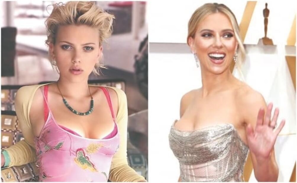 Famosos que recurren a la cirugía estética para ser mejores