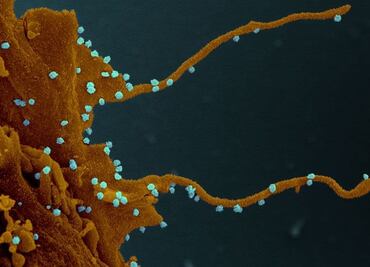 La transformación que el Sars-Cov-2 provoca en las células humanas infectadas