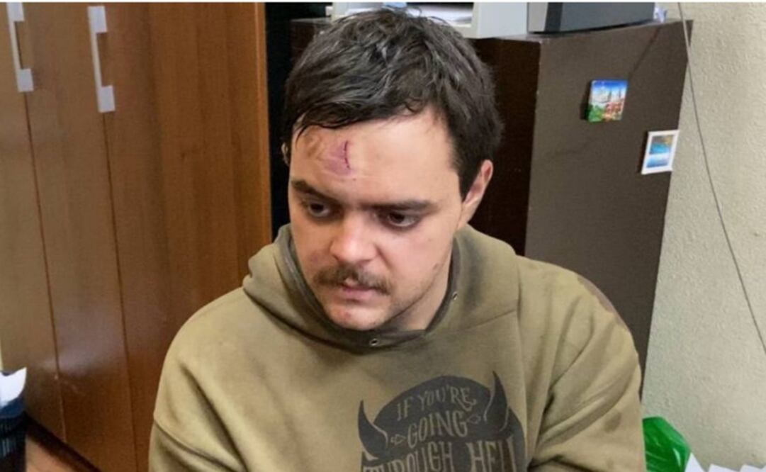 "No tenemos comida ni municiones. Espero que esta guerra termine pronto", dijo el militar. Foto: Twitter @cossackgundi