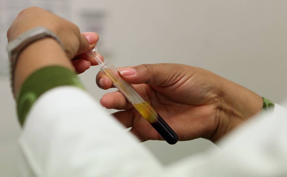 Desde el 2015 hasta el 2021, las investigaciones comenzaron a revelar la relación entre hormonas, inflamación y enfermedades metabólicas y prostáticas. | Foto: Archivo