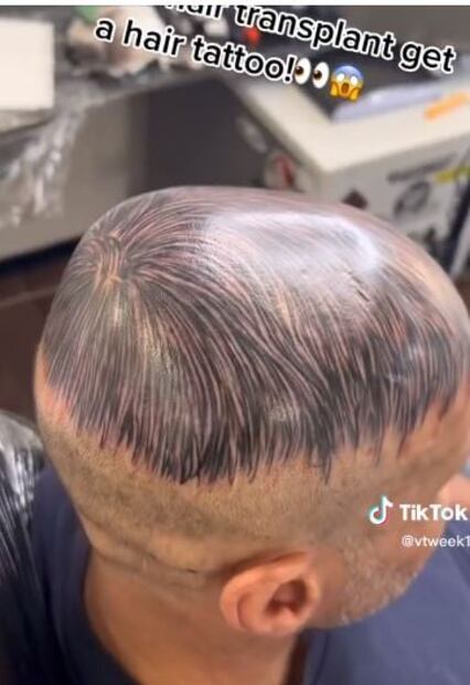 Hombre se vuelve viral en TikTok por particular truco para disimular la alopecia