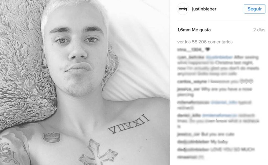 El artista está descubierto del pecho y la cara. Y sí, aparentemente no hay lesiones frontales. FOTO: Instagram/justinbieber.