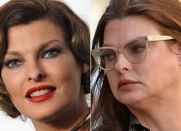 ¿Qué es el CoolSculpting, la técnica que le arruinó el rostro a Linda Evangelista?