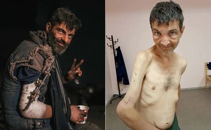 “Fueron brutalmente torturados”: Ucrania denuncia maltrato a sus soldados en manos rusas