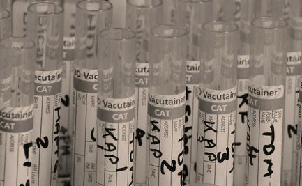 Seleccionan a pacientes de CDMX para ensayo clínico de tratamiento contra Covid-19