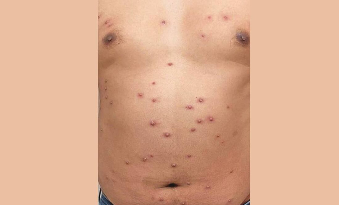 Lesiones como las que aparecen en la gráfica presentó el joven afectado que fue atendido afuera de un hospital, en la banqueta, donde enfermeras le tomaron fotos. Foto: Especial.