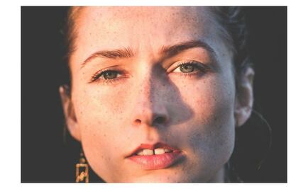 Identifica 10 tipos de manchas faciales peligrosas en menos de 10 minutos