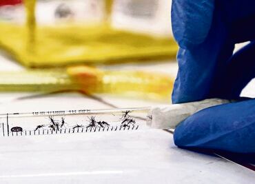 Confirman primer caso de microcefalia asociado al Zika en México