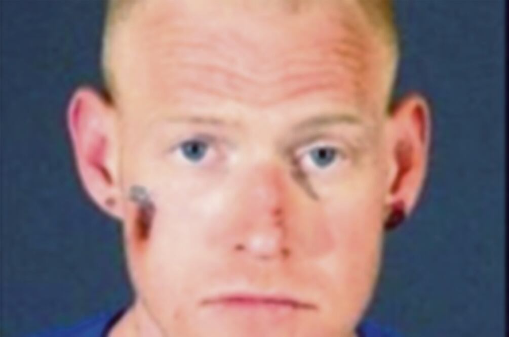 O’Neil ha enfrentado problemas por su adicción a las drogas. Foto: CORTESÍA