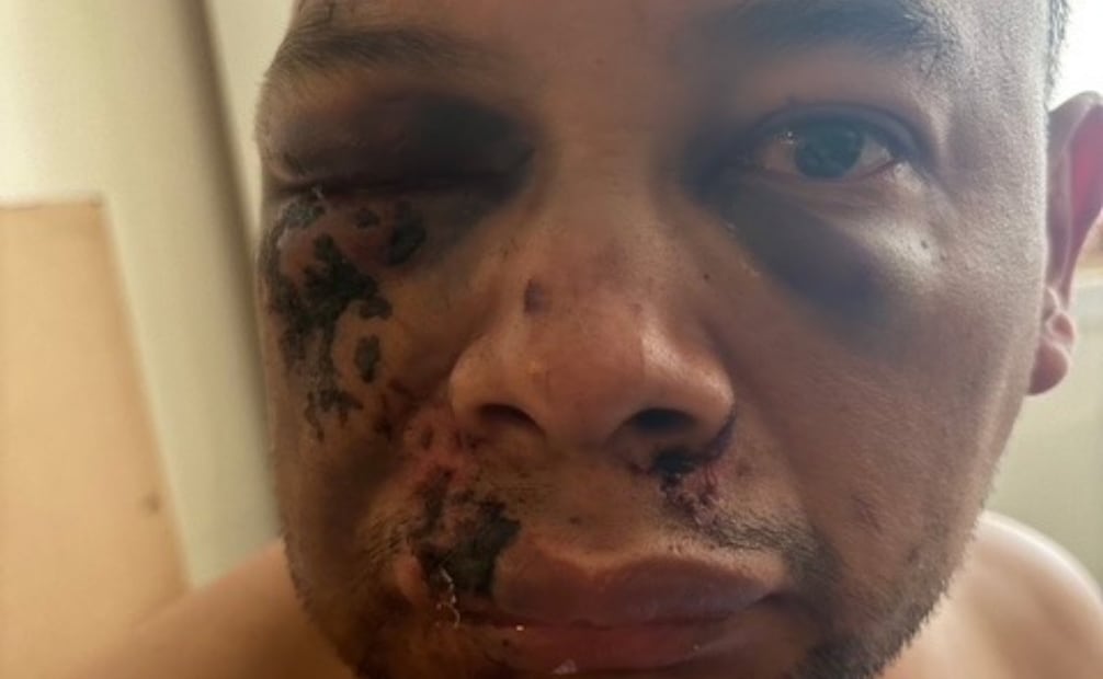 Mexicano denuncia violenta detención del ICE en Virginia (17/08/2026). Foto: Especial