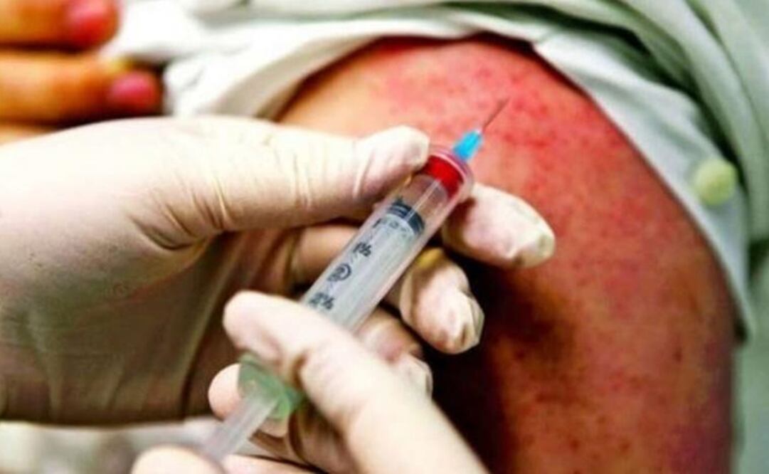 "El virus del sarampión siempre encuentra niños no vacunados", afirmó Henrietta Fore, directora de UNICEF. Foto: Archivo EL UNIVERSAL 