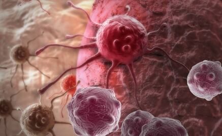 ¿Adiós a las biopsias? Este pequeño dispositivo podría ser la alternativa